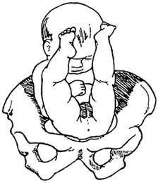Frank Breech Position